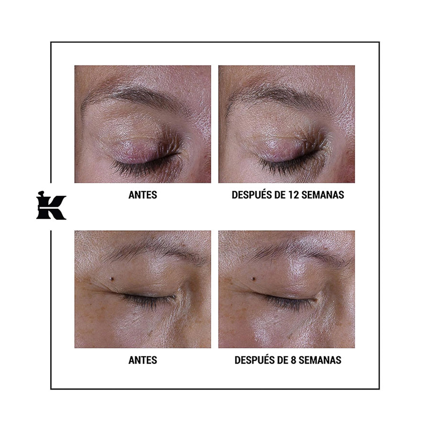 SUPER MULTI-CORRECTIVE EYE ZONE TREATMENT (CREMA ANTI-EDAD PARA CONTORNO DE OJOS)